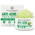 Bella Vita Organic Anti Acne Face Gel Creme